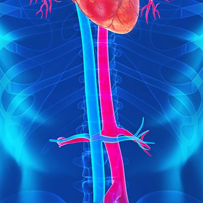 aorta-duplex1 aorta-duplex1